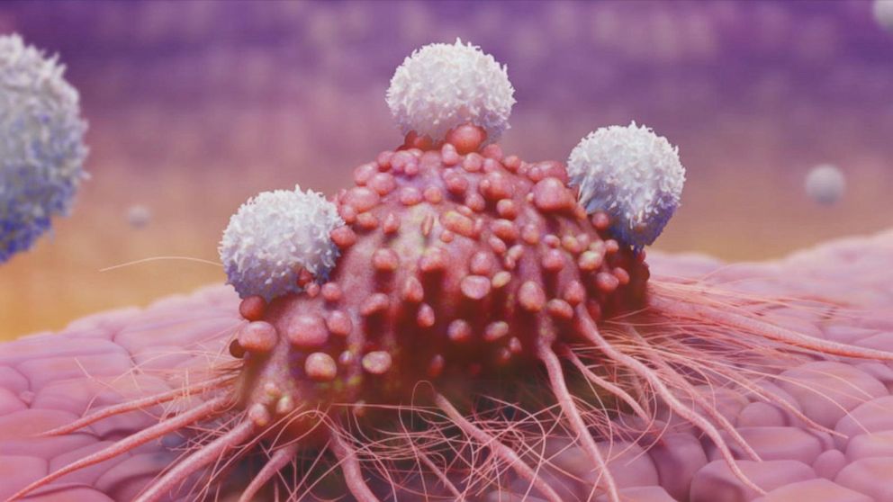 'War on most cancers' metaphors can also do harm, studies shows 12