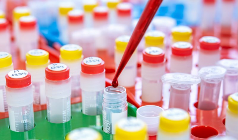 More breast cancer being diagnosed in young women 15