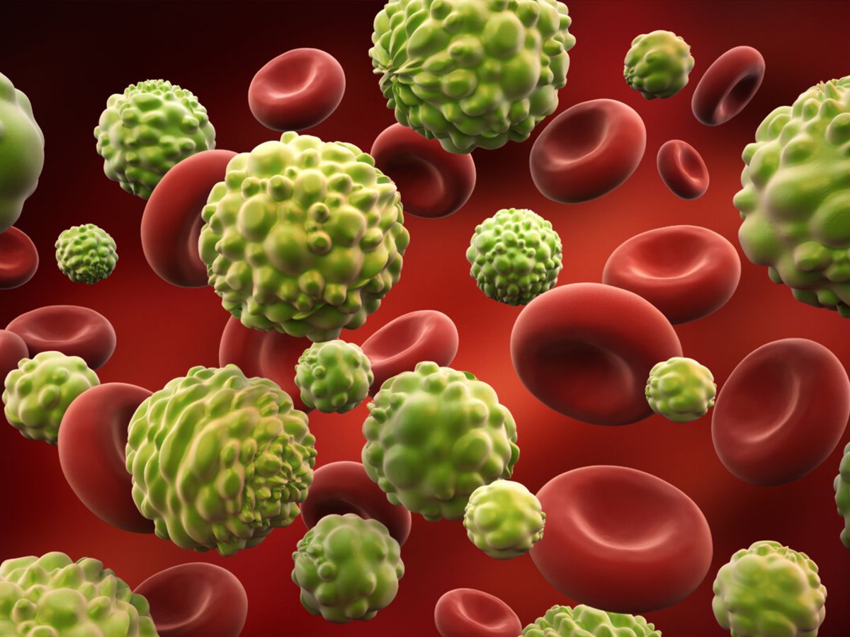 UK cancer remedy ‘revolution’ as survey 10