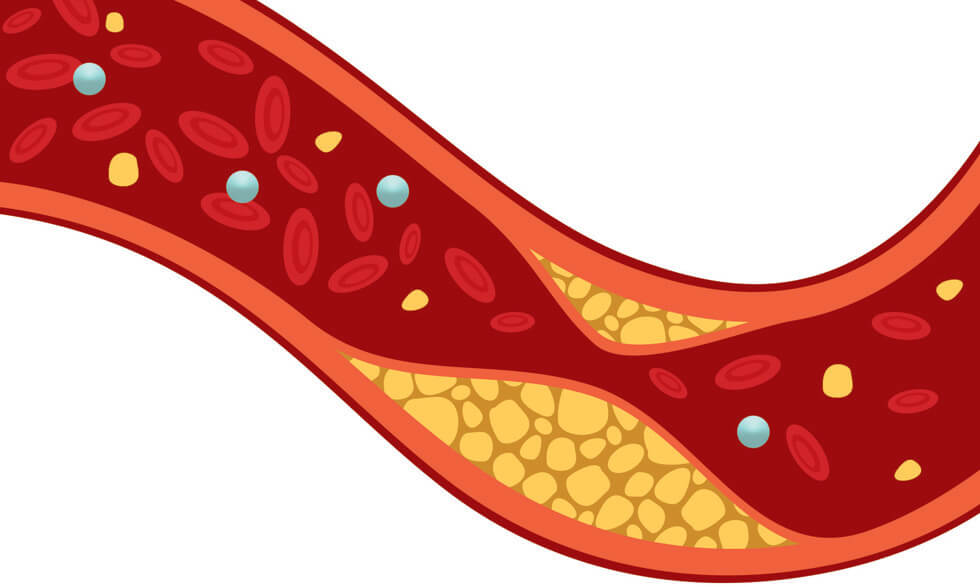 Gemini launches ‘ldl cholesterol cutter’ campaign for its Rice Bran Oil 16
