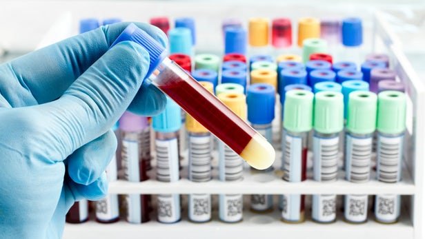 Red meat can increase chances of breast cancer: Study 15