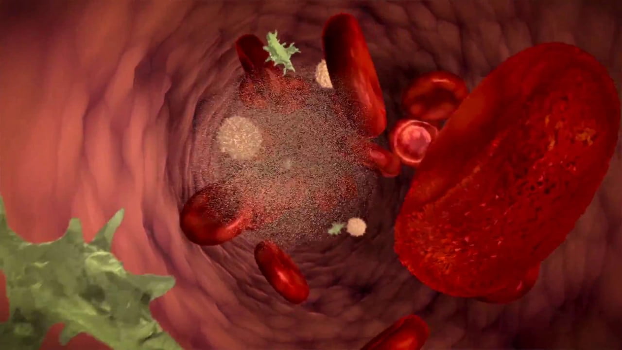 Having a Close Relative With Blood Cancer Boosts One's Own Risk 1