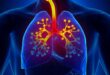 Can Asthma Be Cured in the Future? 12