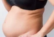 Why Do You Have Bloated Stomach and Back Pain? 12