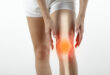 Knee Pain Back - What Causes Knee Pain Back? 17