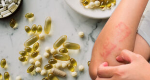 Eczema dietary supplements 2
