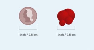 Golf Ball Sized Blood Clots: A Dangerous Health Concern 2