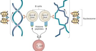 Understanding High Anti-dsDNA Levels 4